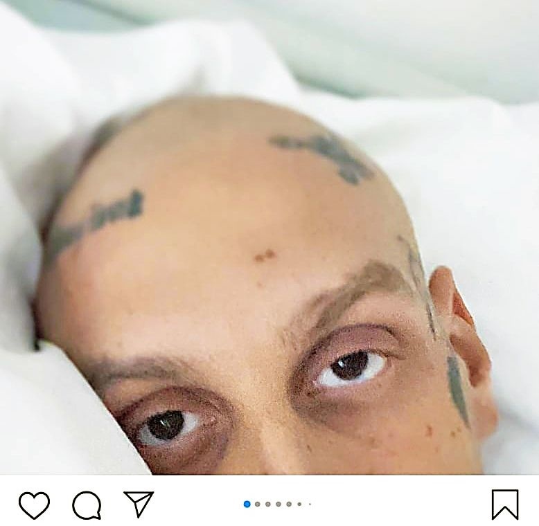 Separ bojoval s rakovinou.
