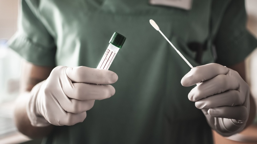 nurse holds a swab for the coronavirus / covid19 test