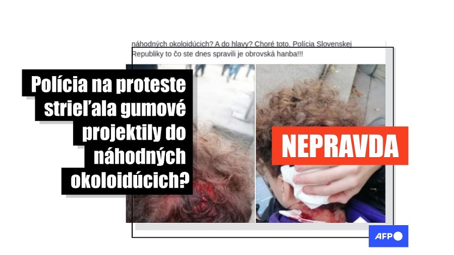Mladík bol medzi účastníkmi uvedeného zhromaždenia od začiatku a pohyboval sa v blízkosti agresívnych výtržníkov.