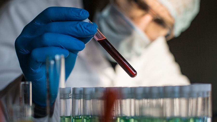Researcher looking on blood