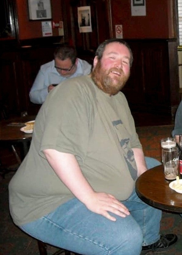Phil býval morbídne obézny.