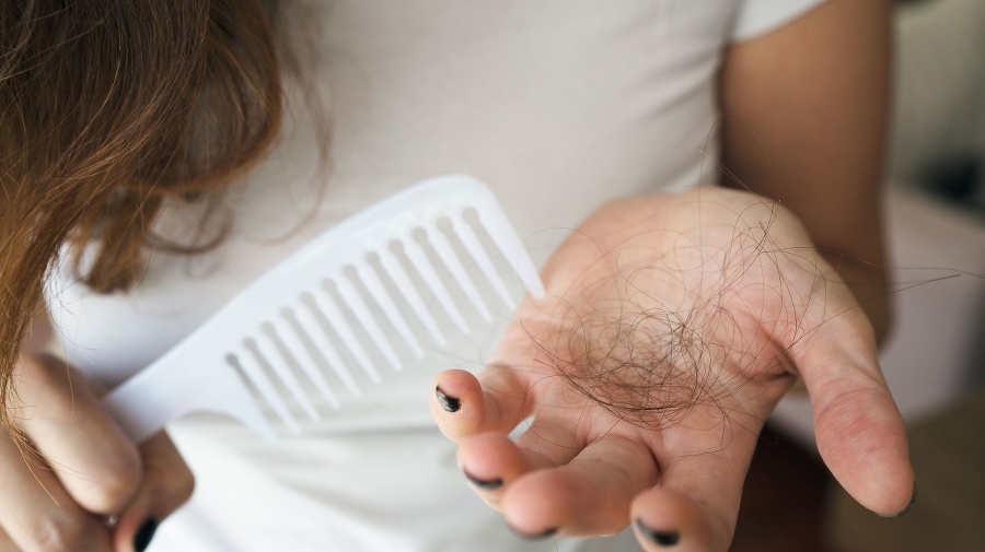 Woman losing hair on