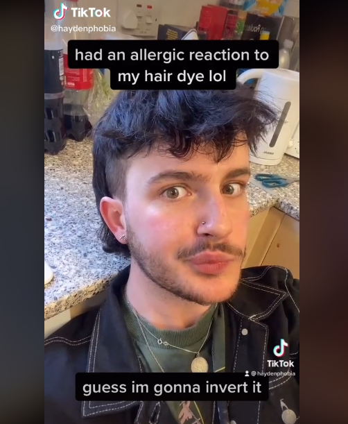 Mladý muž dostal alergickú