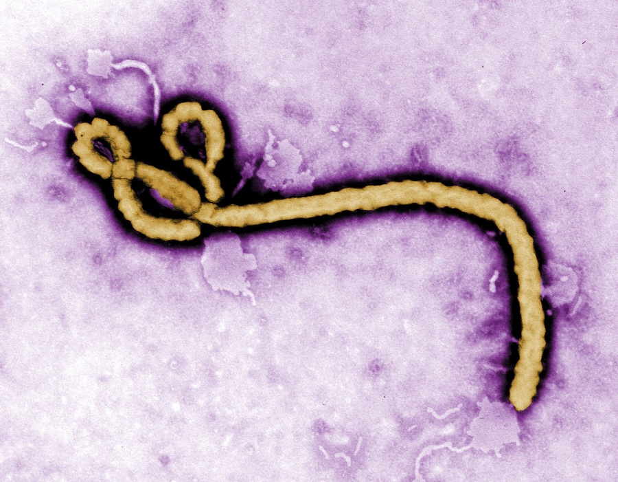 Na snímke vírus eboly