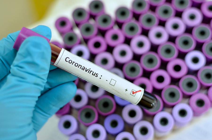 Koncentrácia častíc koronavírusu v