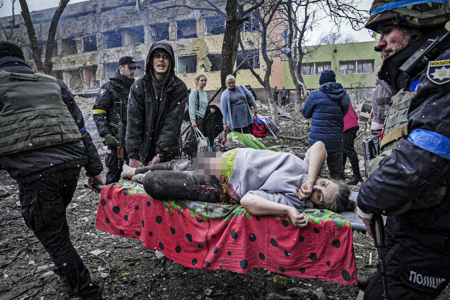 Bombardovali pôrodnicu: Rusi sa na Ukrajine neštítia ostreľovať aj pôrodnice. Lekári , ktorí utiekli, sa však snažia pomáhať aspoň na Slovensku. 
