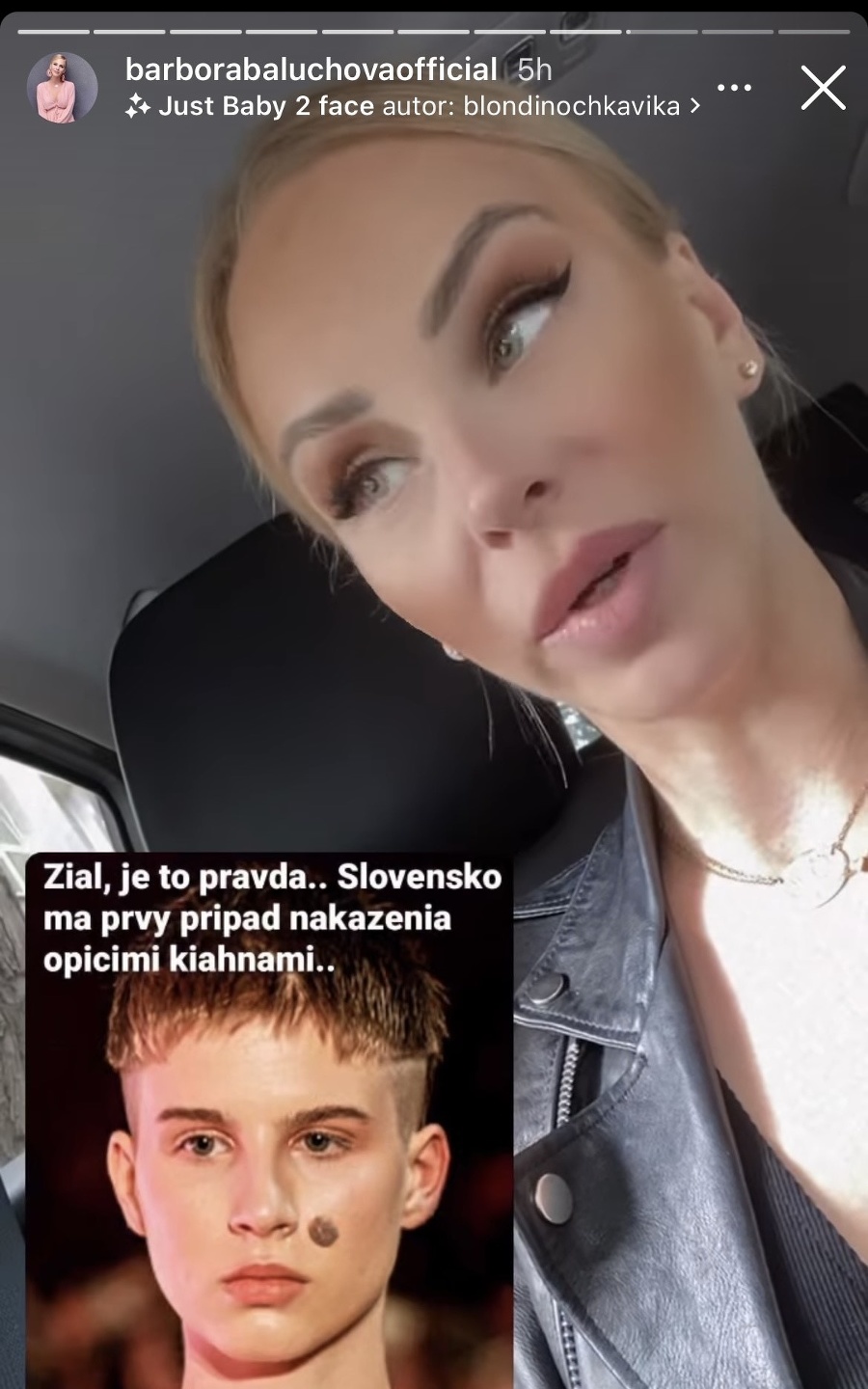Speváčka Barbora Balúchová reagovala