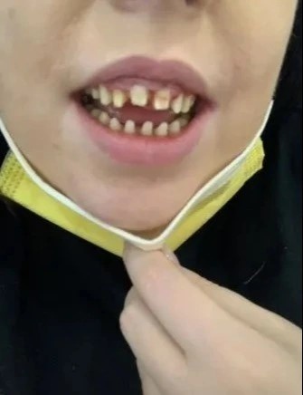 Takto vyzerali jej zuby
