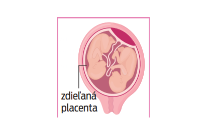 zdieľaná placenta