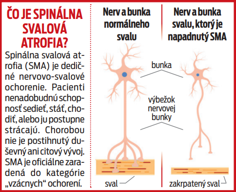 Čo je Spinálna svalová