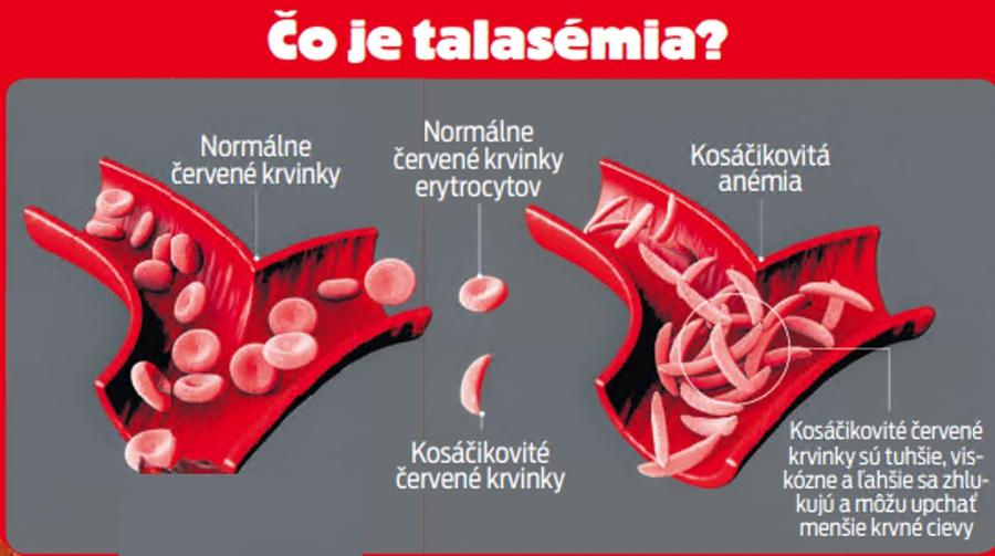 Čo je talasémia?
