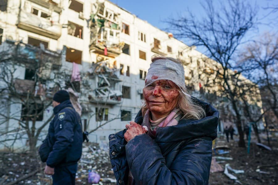 Zranená učiteľka Olena Kurilo