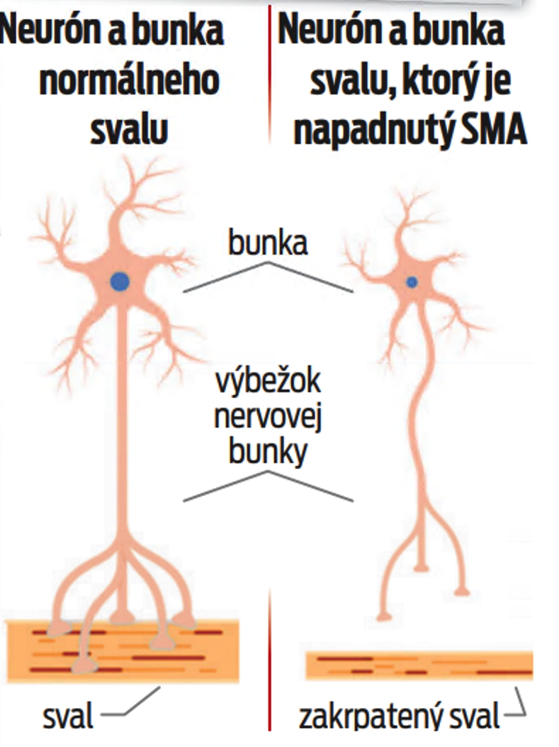 Porovnanie neurónov a buniek.