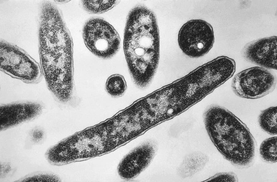 Na snímke z mikroskopu z roku 1978, ktorú sprístupnilo Centrum pre kontrolu a prevenciu chorôb, sú zobrazené baktérie Legionella pneumophila, zodpovedné za spôsobenie pľúcnej choroby známej ako legionárska choroba.