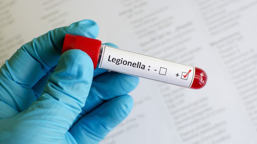  Nebezpečná baktéria legionella