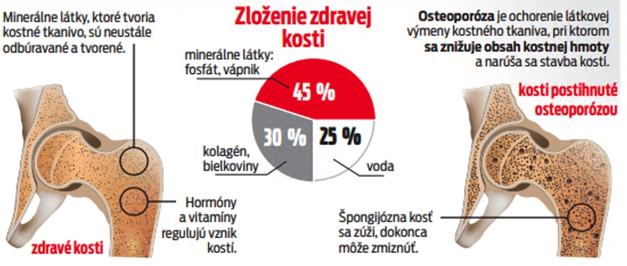 Zloženie zdravej kosti