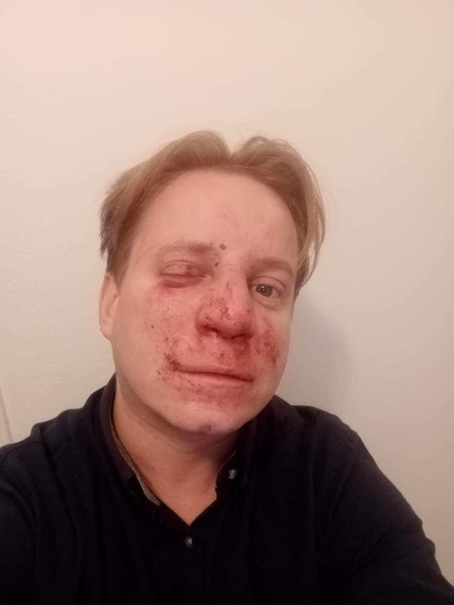 Kozáka napadol agresívny útočník. 