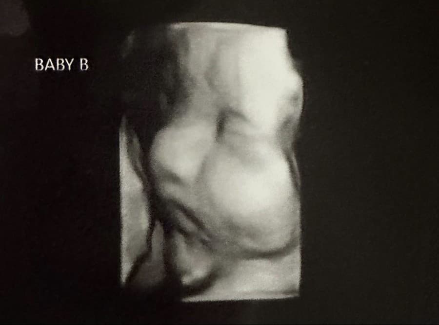 Záznam z ultrazvuku.