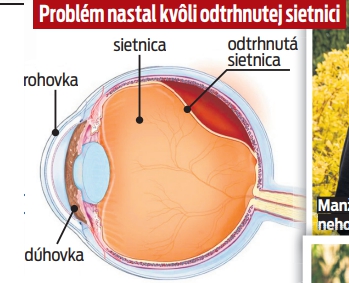 Problém nastal kvôli odtrhnutej