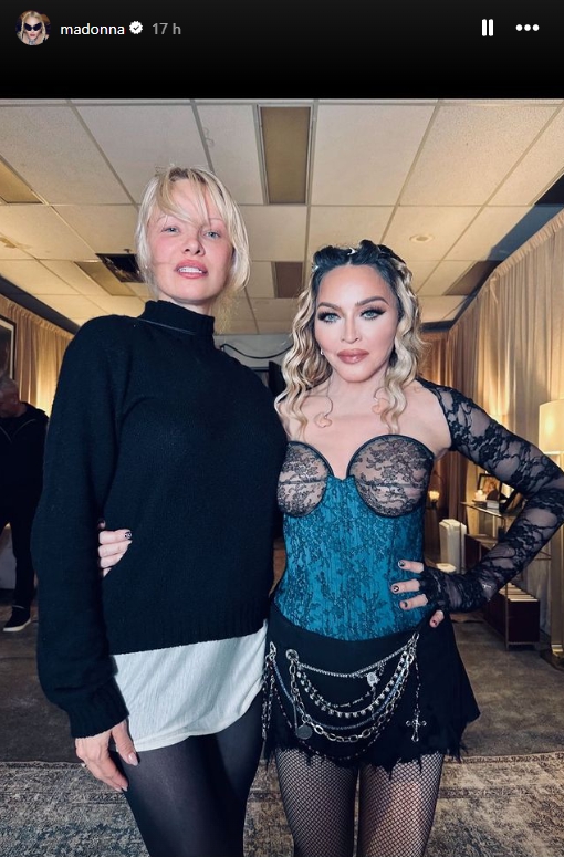 Na Madonninom koncerte sa objavila Pamela Anderson.