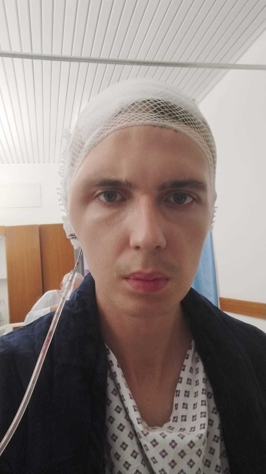 Gabriel (29) z Rimavskej Soboty skončil v kóme a s vážnym zranením hlavy potom, čo na ulici zakročil, keď Ladislav (25) napádal svoju priateľku. 