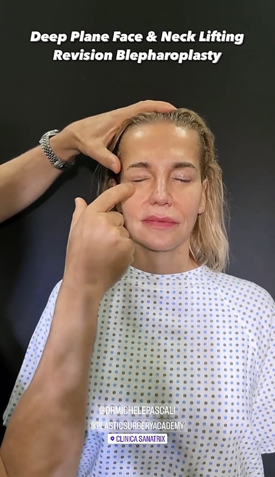 Taliansky lekár zverejnil jej video tesne pred zákrokom.