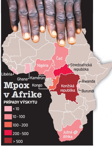 Mpox v Afrike