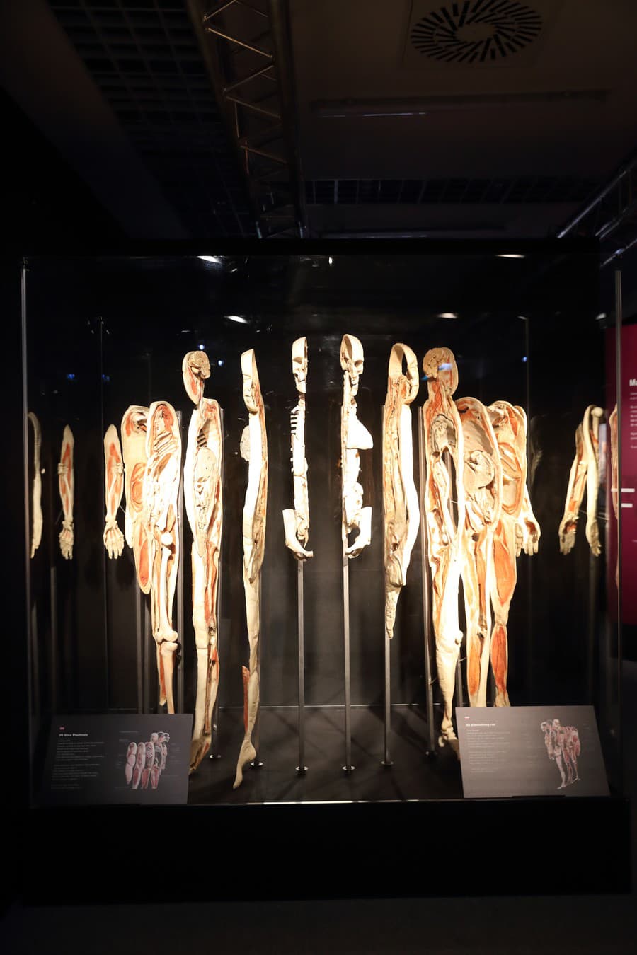 Výstava skutočných ľudských tiel BODY WORLDS.
