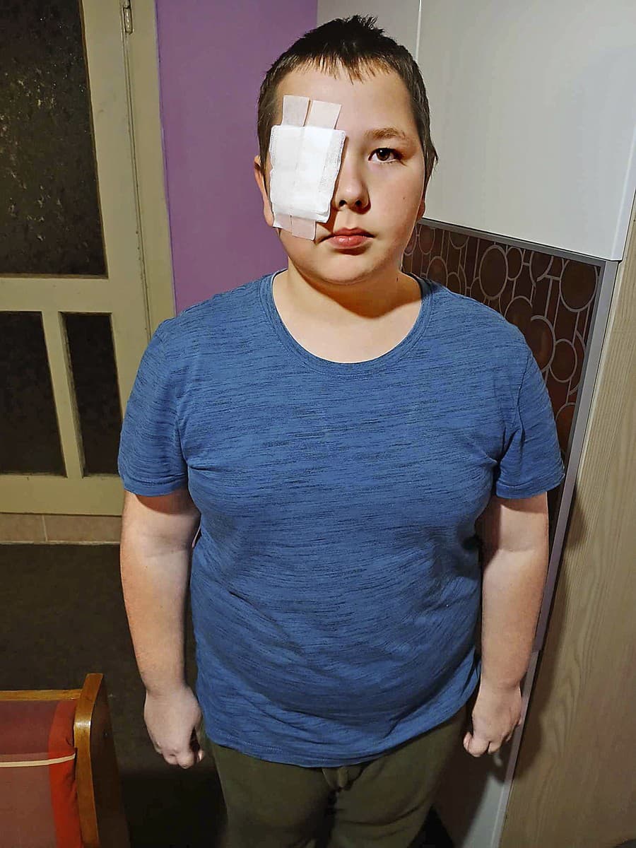 Zoli (10) má poranené oko a musí pravidelne dochádzať za rehabilitáciou. To je pre rodinu priam likvidačné...