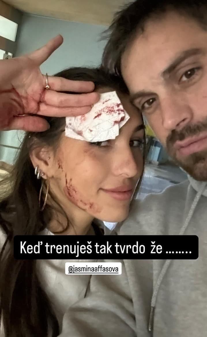 Obaja pri tréningu utrpeli zranenie.
