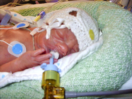 Chlapček sa narodil s meningitídou, ktorá mu znemožňovala chodiť.