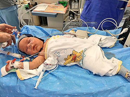 Dvojmesačný: Lekári pri zákroku nemuseli chlapčekovi otvárať hrudník, operovali ho pomocou katétra určeného pre dospelých.
