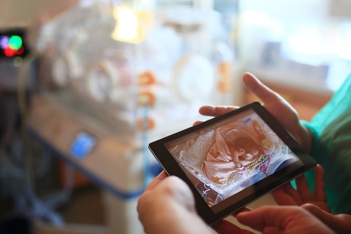 Neonatologické pracoviská umožňujú rodičom vidieť svoje deti cez fotografie.