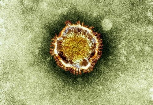 Na snímke nový typ koronavírusu, ktorý pochádza z rovnakej skupiny ako vírus SARS.