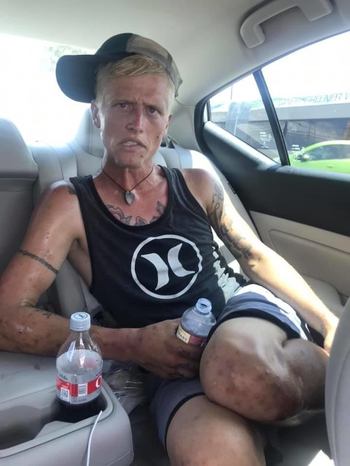 Sedem mesiacov života drogovo závislého bezdomovca spravilo z Codyho trosku.
