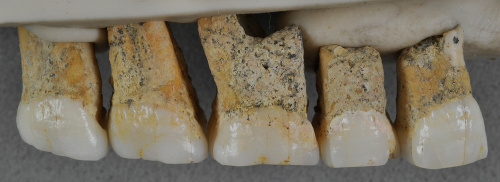 Pravé horné zuby jedinca identifikovaného ako Homo luzonensis