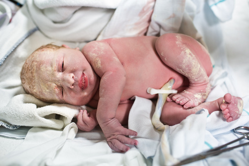 Newborn baby right after birth.