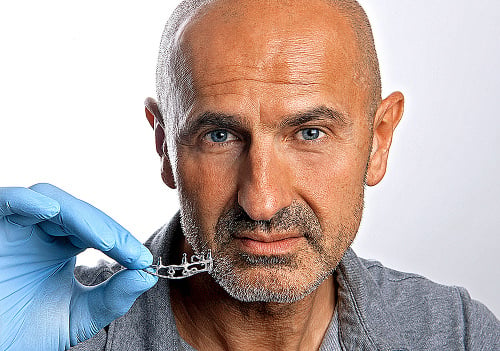 Zubár Dušan Drábik s unikátnym kúskom, ktorý váži len 1 gram.