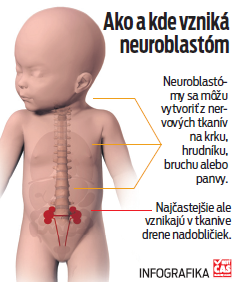 Ako a kde vznká neuroblastóm.