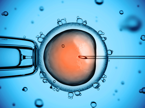 Do vajíčka sa pod mikroskopom vloží spermia.