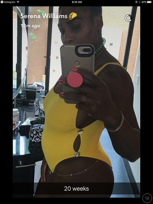 Serena oznámila tehotenstvo touto fotkou.