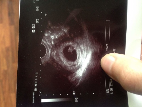 Brunetka sa pochválila snímkou z ultrazvuku.