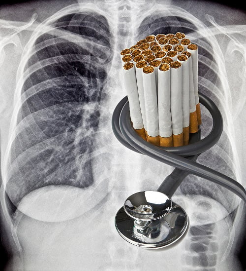 Zdravie fajčiarov nepresvedčí