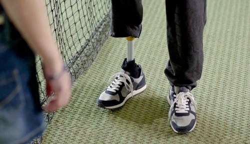 Zaujímavou rekvizitou bola tiež protéza na nohu, ktorú musel nosiť herec Richard Autner 