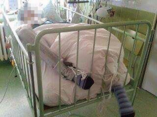 Dievča uložili v nemocnici v Michalovciach do malej postele.