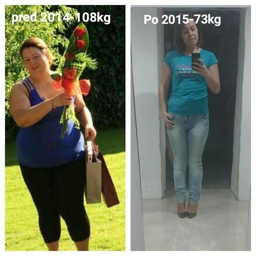 Pred a po: Monika za rok zhodila 35 kíl.