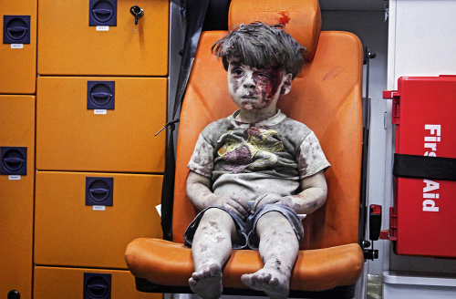 Chlapček Omran (5) sa stal symbolom vojny v Sýrii.