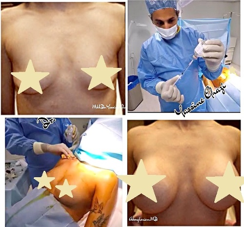 Takto sa fotografoval falošný plastický chirurg so svojim pacientkami.
