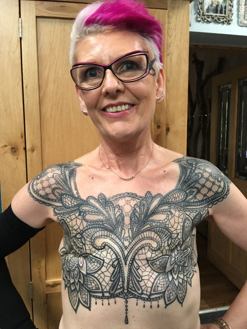 Sue implantáty pŕs odmietla. Namiesto toho si dala spraviť tetovanie.