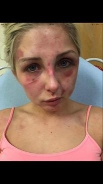 Jej tvár bola samá rana.